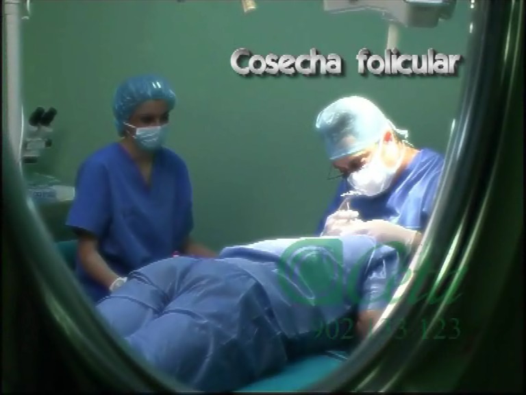 750 pacientes intervenidos de Trasplante Capilar
